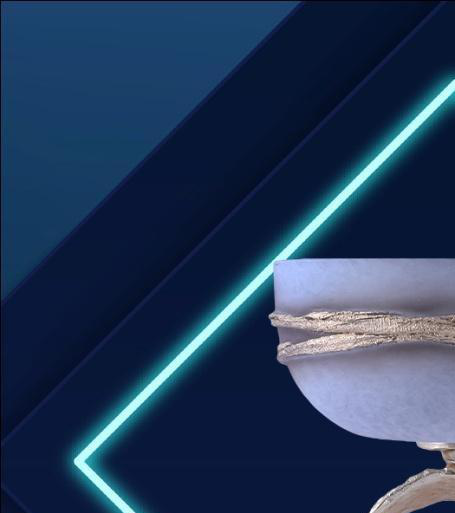 METAL BOWL - 29250 - Image 2