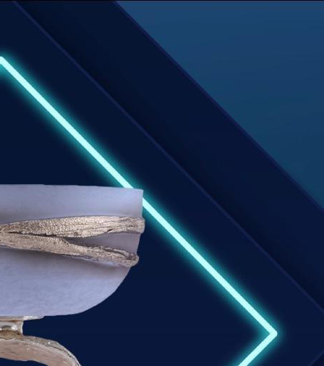 METAL BOWL - 29250 - Image 3